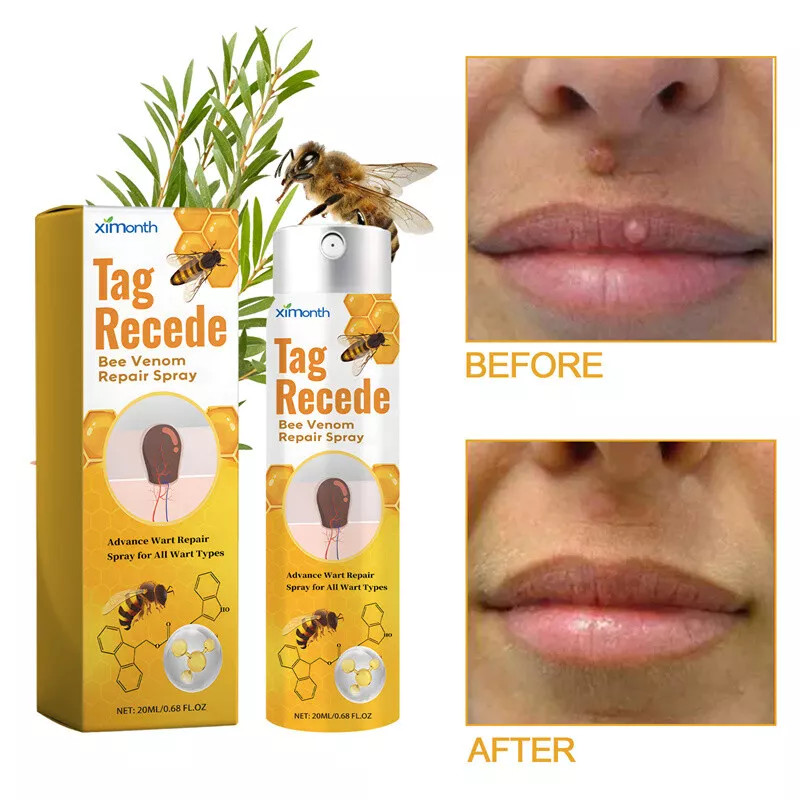 2× Tag Recede Bee Venom Treatment Spray Tag Recede for All Skin Bee Venom Spray