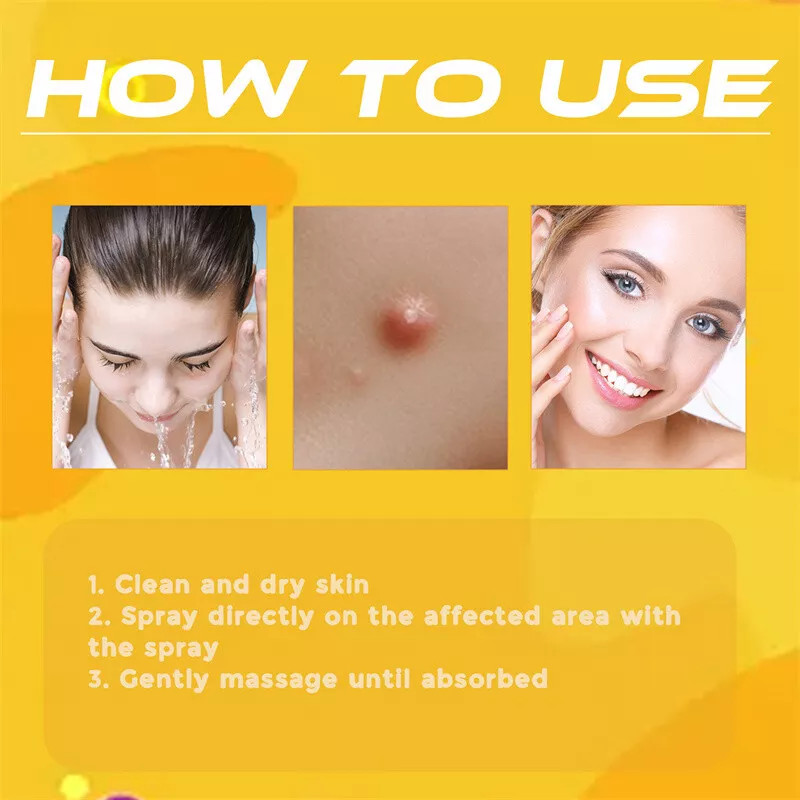 2× Tag Recede Bee Venom Treatment Spray Tag Recede for All Skin Bee Venom Spray