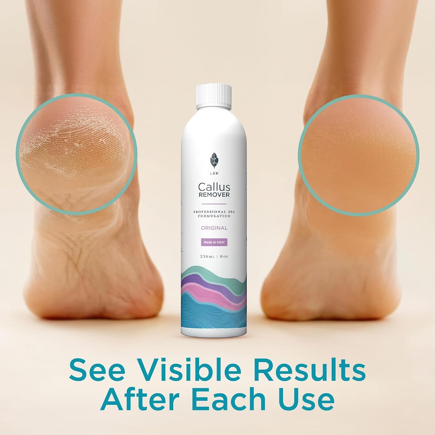 Lee Beauty 8oz Professional Gel Callus Remover for Feet – Original Fast-Acting