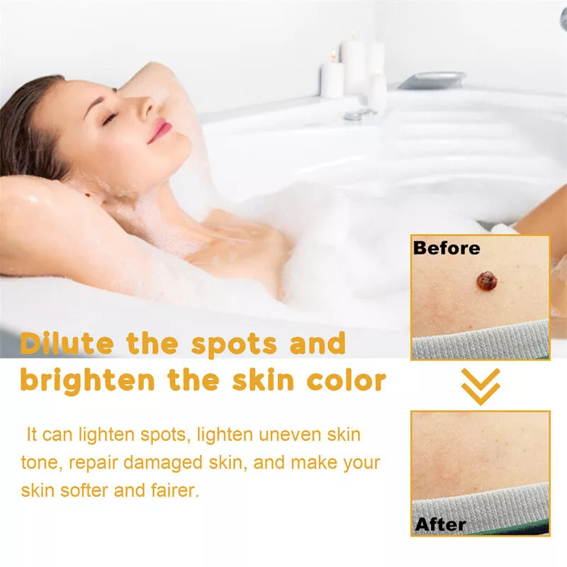 2× Tag Recede Bee Venom Treatment Spray Tag Recede for All Skin Bee Venom Spray