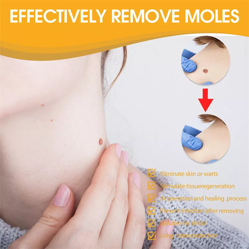 2× Tag Recede Bee Venom Treatment Spray Tag Recede for All Skin Bee Venom Spray
