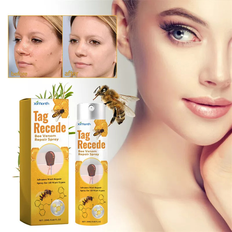 2× Tag Recede Bee Venom Treatment Spray Tag Recede for All Skin Bee Venom Spray
