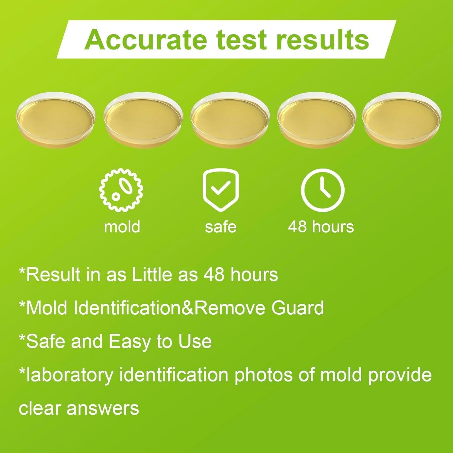 Mold Test Kit for Home – 5 Pack Individual Tests,Diy Detector at Home – New