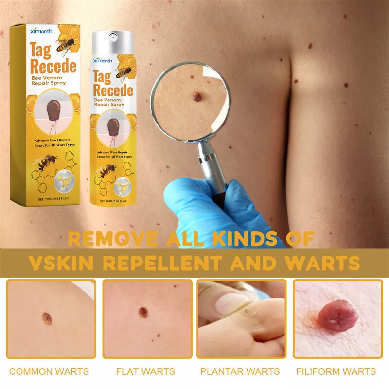 2× Tag Recede Bee Venom Treatment Spray Tag Recede for All Skin Bee Venom Spray