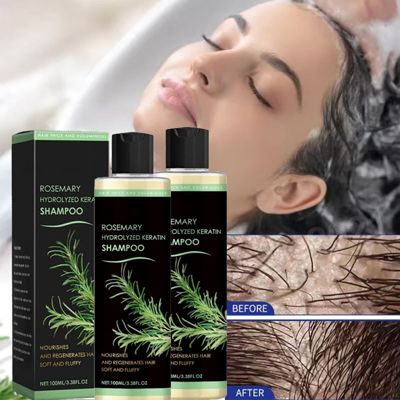 3 Pack Organic Rosemary Hair Growth Shampoo for Women and Men-Natural Thickening
